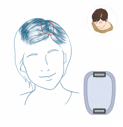 초경량에 탈모 어느부위 든 간단히 커버 가능한 제품