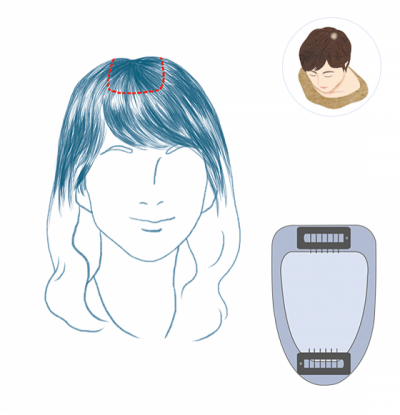 가볍고 부담없이 사용가능 소형제품으로 간단하고 부담없이 착용 가발을 처음 사용하는 고객에게 적합