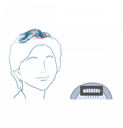 소형제품으로  정수리 등 간단하고 부담없이 착용 가능 가발을 처음 사용하는 고객에게 적합